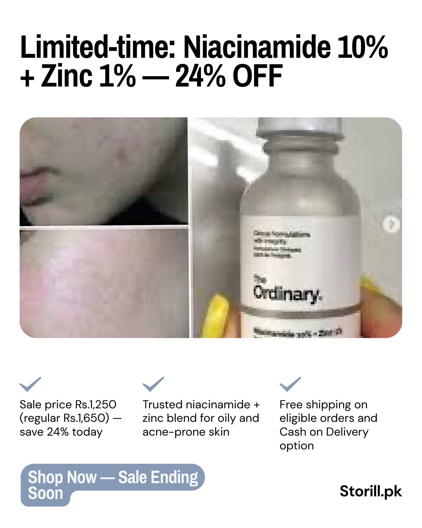 The Ordinary Niacinamide 10% + Zinc 1% – 30ml